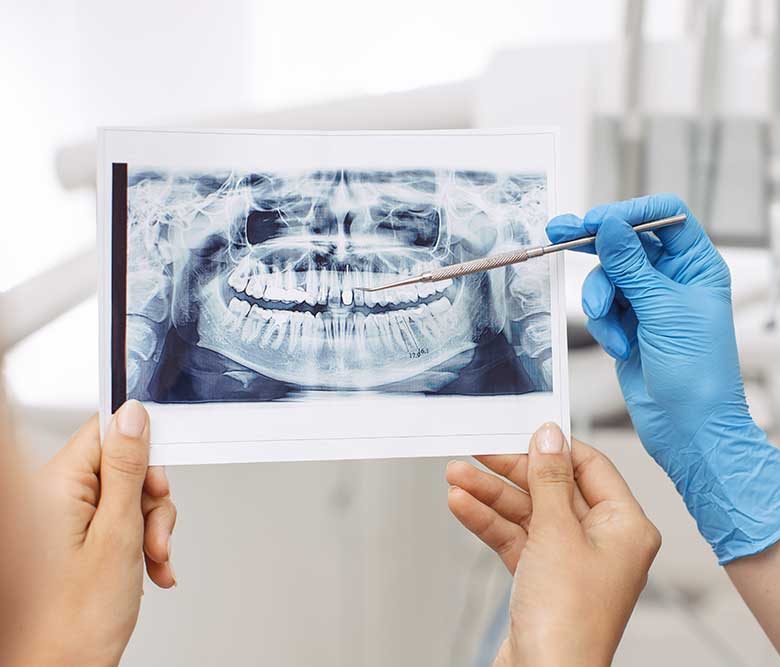 dentist showing xray image to patient | Featured image for How are Wisdom Teeth Removed? | Blog